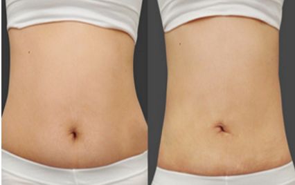 北京哪家醫(yī)院有優(yōu)質(zhì)的兔唇修復(fù)醫(yī)療服務(wù)？