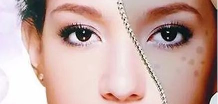 周一雄如何預(yù)約雙眼皮手術(shù)？案例分享與價(jià)格真實(shí)評估