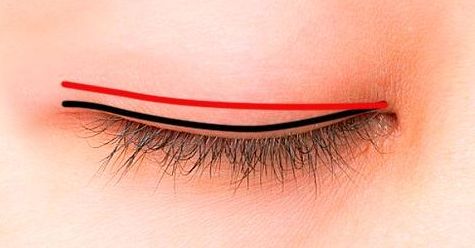 曹衛(wèi)剛修復(fù)雙眼皮技藝優(yōu)異，想知道他的專長嘛？進(jìn)來看看吧！