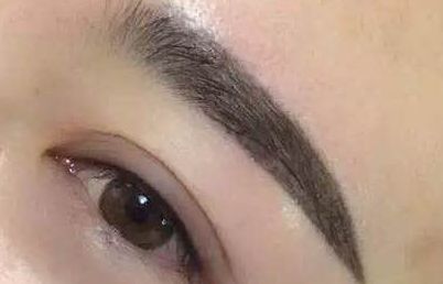 廈門鄭亞榮醫(yī)師就醫(yī)經歷如何？患者真實案例分享及診療費用明細更新！