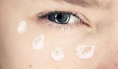 皮肉腔軟骨隆鼻手術(shù)費(fèi)用如何？鼻部整形手術(shù)安全可靠，詳細(xì)操作圖解！