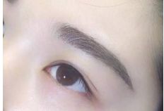 重慶銅雀臺地區(qū)雙眼皮手術(shù)頂級醫(yī)生推薦！詳細(xì)收費一覽表