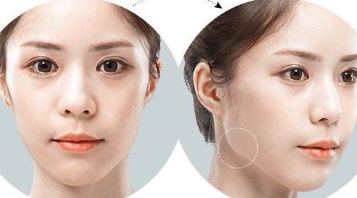 北京五家專業(yè)美容醫(yī)院熱門推薦，實(shí)力醫(yī)院排行榜快來收藏！