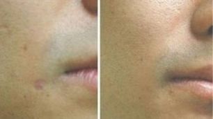 江蘇省人民醫(yī)院眼科頂尖大咖曬出｜五位名醫(yī)的醫(yī)術(shù)實(shí)力和口碑共享