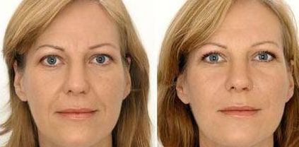 蘭州激光手術(shù)整形美容醫(yī)院排名前八top榜，手術(shù)費用查詢