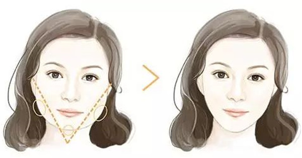 深圳吸脂修復(fù)醫(yī)院哪家專業(yè)？這八強(qiáng)機(jī)構(gòu)到底有何絕技？