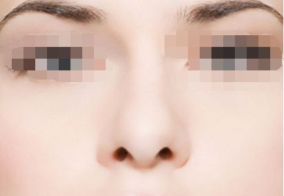 上海九院鼻部整形十強(qiáng)醫(yī)生名單公布，修復(fù)專家排名引人矚目