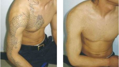 南昌紅谷灘區(qū)有什么好的整形美容醫(yī)院？