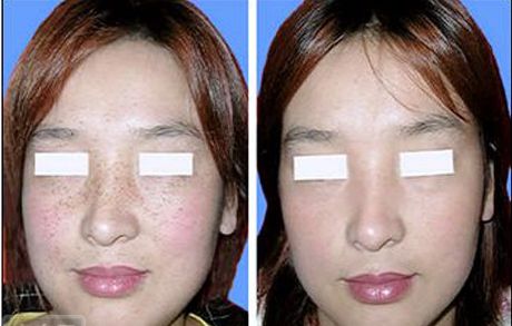 貴陽(yáng)市哪家三級(jí)綜合整形醫(yī)院比較靠譜？