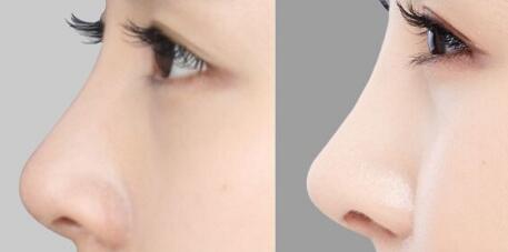 廣州隆胸修復(fù)有哪些值得信賴的醫(yī)院？豐滿胸部是否真的可行？