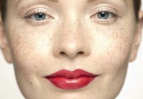 曙光整形醫(yī)院受追捧，隆鼻成功案例分享