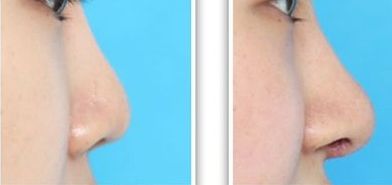 廣州星念醫(yī)療美容醫(yī)院美容項(xiàng)目價(jià)格一覽表