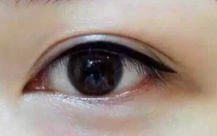 上海9院專家分享軟骨隆鼻案例，LiQingfeng的技術備受推崇！