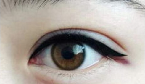 廣東做隆鼻哪家醫(yī)院的技術(shù)好？這五家公立醫(yī)院是值得一試的嗎？