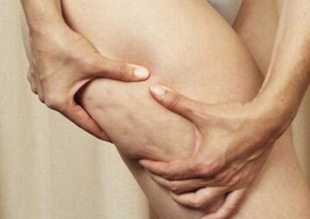 深圳哪家醫(yī)院拉皮手術(shù)效果好？專家推薦米蘭柏羽、美萊、藝星等醫(yī)院