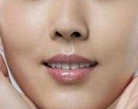 上海眼科專家魏少魁2023年眼睛矯正技術(shù)實(shí)戰(zhàn)分享