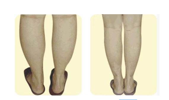 福州雷雪華醫(yī)生打造的鼻子效果如何？醫(yī)生實力及案例揭示