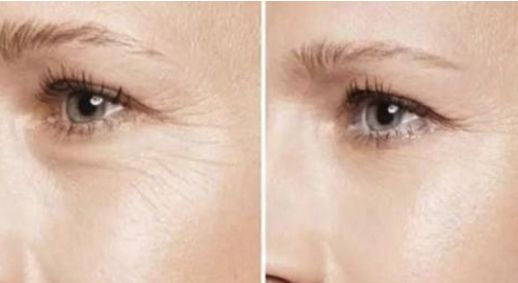 昆明雙眼皮手術(shù)哪家醫(yī)院靠譜？這三家值得了解