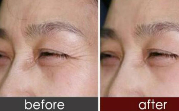 懷化哪家醫(yī)生能治療O型腿矯正？極力推薦的具體醫(yī)生是誰？