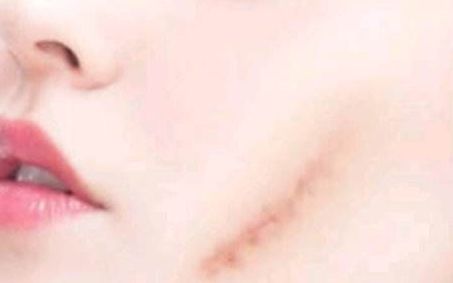 北京雙眼皮手術(shù)，牛人醫(yī)生排行揭秘