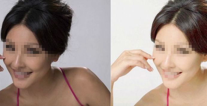 鄭州第二中醫(yī)院專家推薦：私密整形服務詳解，朱靜醫(yī)生實力解讀