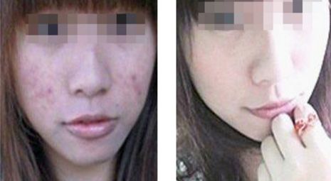 2024年蘇州市整形醫(yī)院鼻部修復(fù)手術(shù)前十強(qiáng)大揭秘