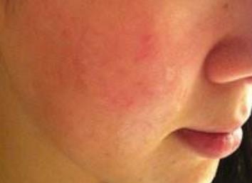 湖南公立醫(yī)院整形科有哪些高水準(zhǔn)的本地靠譜機(jī)構(gòu)？