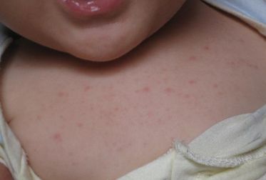 張凱華醫(yī)生：秦皇島巧致整形醫(yī)院人氣美膚專(zhuān)家激光祛斑分享