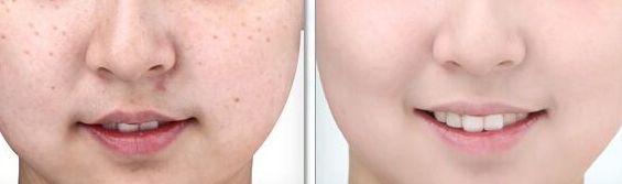 醫(yī)生工作室的預(yù)約方式介紹！蘇薇潔醫(yī)生眼整形工作室的成功案例展示！