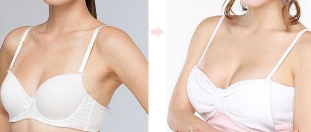 濟南第二人民醫(yī)院雙眼皮手術(shù)費用和名醫(yī)推薦，有成功案例參考