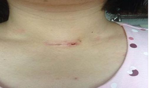 錦州附屬二院口腔修復(fù)科優(yōu)秀專(zhuān)家團(tuán)隊(duì)及種植牙成功案例匯總