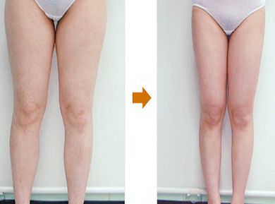 上海柴軍醫(yī)生的鼻子整形案例亮相，效果如何？