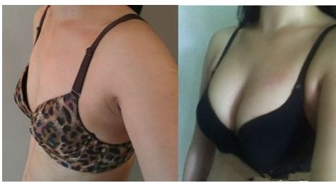 重慶華美眼科醫(yī)生排行榜！五位專家引領潮流，獨家案例與預算揭秘！