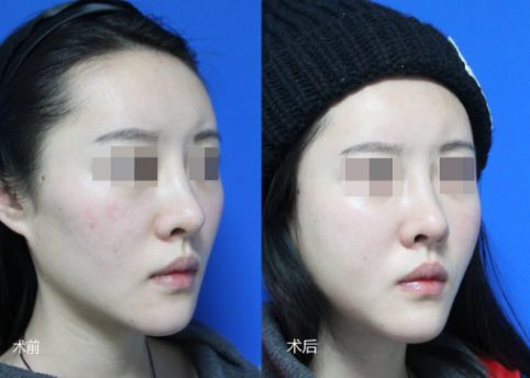 西安市三甲整形醫(yī)院綜合排行榜火熱發(fā)布