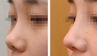 上海第九人民醫(yī)院乳房重塑的頂尖醫(yī)生有誰？專家推薦+服務收費參考