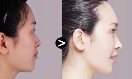 昆明專業(yè)整形治療醫(yī)院揭秘！口碑TOP10震撼推薦，守護(hù)您的隱私需求！