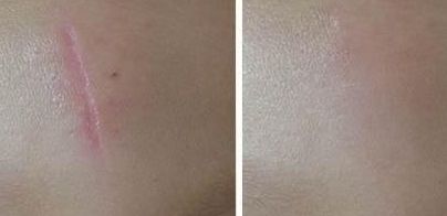 尋覓醫(yī)術(shù)出眾的武漢雙眼皮修復(fù)醫(yī)生，誰(shuí)是不二之選？