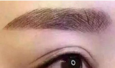 九院瞬間靚眼，告別上眼瞼下垂困擾，醫(yī)術(shù)專業(yè)獨(dú)具慧眼！