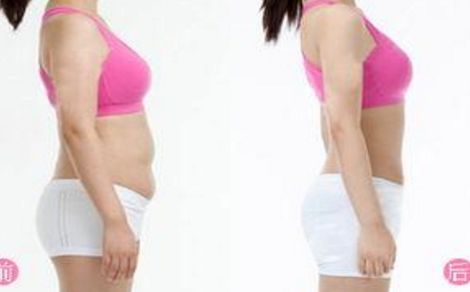 上海哪家做脂肪填充醫(yī)院好？杰出醫(yī)生張懷軍和桑建波如何評(píng)價(jià)？