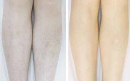 重慶植入乳房改良領(lǐng)先醫(yī)院：五佳選擇推薦