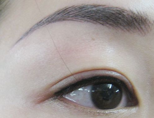 上海九院金云波醫(yī)生口碑大揭秘！驚艷新款雙眼皮修復(fù)案例曝光