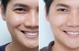 西安整容業(yè)近年來(lái)蓬勃發(fā)展，隆鼻手術(shù)備受矚目。在眾多醫(yī)生中脫穎而出的五位西安隆鼻名醫(yī)令人信服！他們來(lái)自