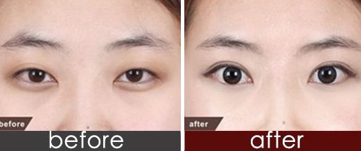 上海市九院品牌種植牙醫(yī)生推薦！頂尖口腔權(quán)威專(zhuān)家聯(lián)合推薦，價(jià)格一覽！