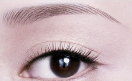 雙眼皮手術(shù)合適的適齡階段是哪個年紀段位更勝一籌？