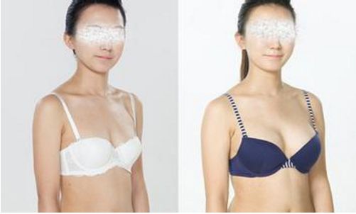 深圳專業(yè)私密整形醫(yī)院排名榜前八Top醫(yī)療機(jī)構(gòu)速覽