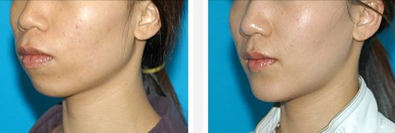 吉林梁惟苓整形醫(yī)院專業(yè)項(xiàng)目與技術(shù)介紹