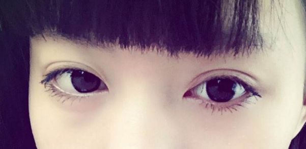 靠前重慶眼部整形醫(yī)院榜單出爐，時光整形受認(rèn)可