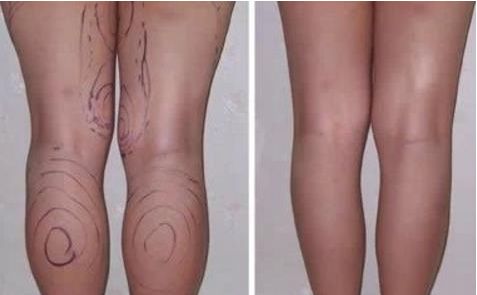 廣東省整形醫(yī)院新聲，權威排名榜單曝光