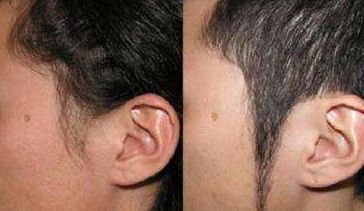 北京輕醫(yī)美整形醫(yī)院推薦，微整形首選！