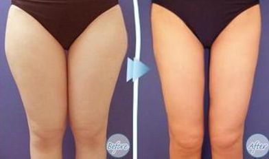 杭州痤瘡修復(fù)?？漆t(yī)院推薦